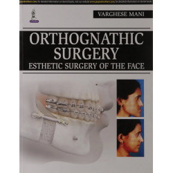 ORTHOGNATHIC SURGERY ESTHETIC SURGERY OF THE FACE book by Varghese Mani