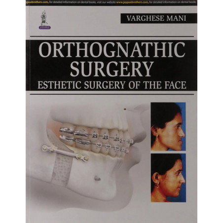 ORTHOGNATHIC SURGERY ESTHETIC SURGERY OF THE FACE book by Varghese Mani