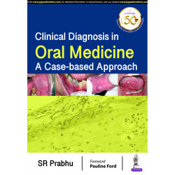 CLINICAL DIAGNOSIS IN ORAL MEDICINE: A CASE-BASED APPROACH book by SR Prabhu, The primary purpose of this book is to integra…