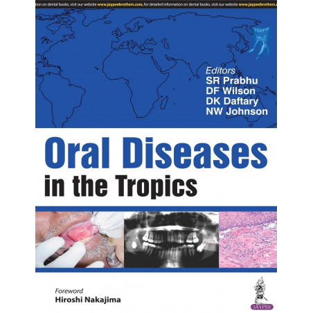 ORAL DISEASES IN THE TROPICS book by S R Prabhu, D F Wilson