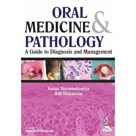 ORAL MEDICINE & PATHOLOGY A GUIDE TO DIAGNOSIS AND MANAGEMENT book by Saman Warnakulasuriya