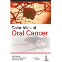 COLOR ATLAS OF ORAL CANCER book by Masthan K.M.K