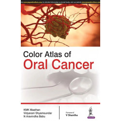 COLOR ATLAS OF ORAL CANCER book by Masthan K.M.K