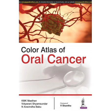 COLOR ATLAS OF ORAL CANCER book by Masthan K.M.K