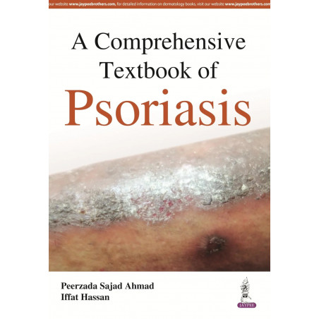 A COMPREHENSIVE TEXTBOOK OF PSORIASIS book by Ahmad Peerzada Sajad