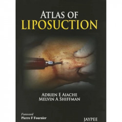 ATLAS OF LIPOSUCTION book by Aiache Adrien.E, Shiffman - Back Cover