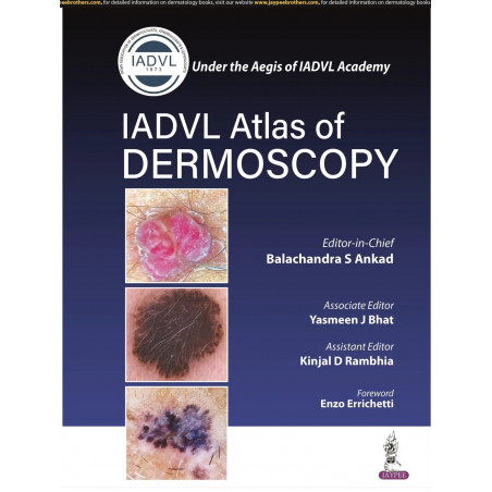 IADVL Atlas of Dermoscopy book by BALACHANDRA S ANKAD