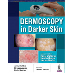 DERMOSCOPY IN DARKER SKIN book by Manas Chatterjee, Shekhar Neema