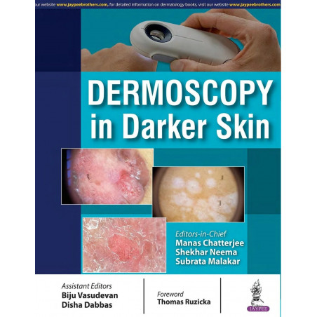 DERMOSCOPY IN DARKER SKIN book by Manas Chatterjee, Shekhar Neema