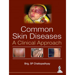 COMMON SKIN DISEASES:A CLINICAL APPROACH book by Chattopadhyay Brig.Sp