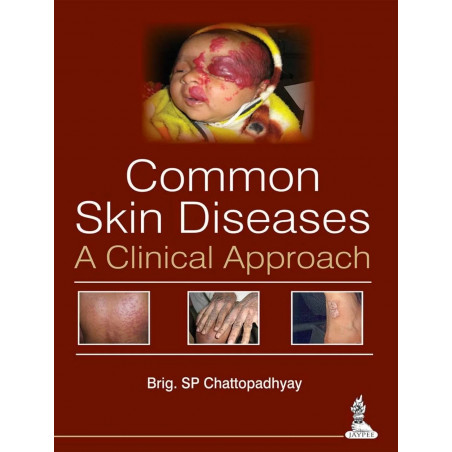 COMMON SKIN DISEASES:A CLINICAL APPROACH book by Chattopadhyay Brig.Sp