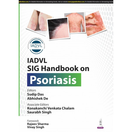 IADVL SIG HANDBOOK ON PSORIASIS book by Sudip Das, Abhishek De