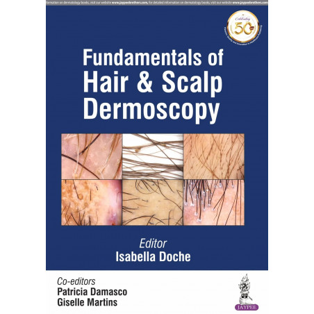 Fundamentals of Hair and Scalp Dermoscopy (POD) book by Isabella Doche, Patricia Damasco