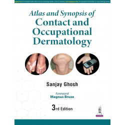 ATLAS AND SYNOPSIS OF CONTACT AND OCCUPATIONAL DERMATOLOGY book by Sanjay Ghosh
