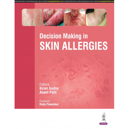 DECISION MAKING IN SKIN ALLERGIES book by Kiran Godse, Anant Patil