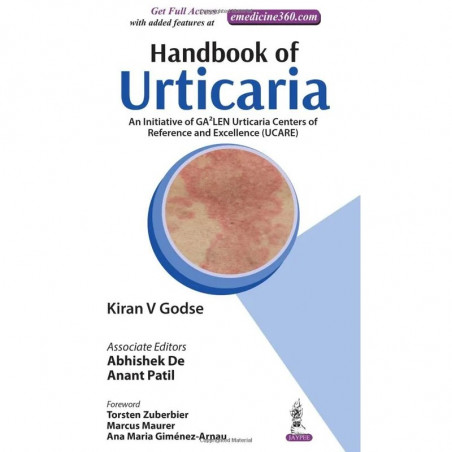 HANDBOOK OF URTICARIA book by GODSE KIRAN V