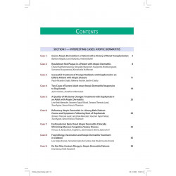 Atopic Dermatitis and Pruritus Interesting Cases (POD) book by KIRAN GODSE - Additional Image 5