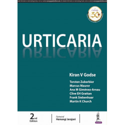 Urticaria (POD) book by Kiran V Godse