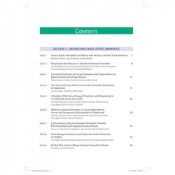 Atopic Dermatitis and Pruritus Interesting Cases (POD) book by KIRAN GODSE - Additional Image 6