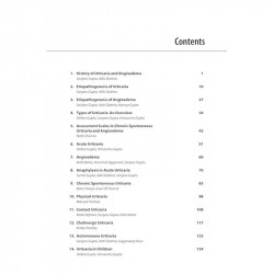 COMPREHENSIVE GUIDE TO URTICARIA book by Sanjeev Gupta, Rohit Batra - Additional Image 6