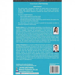 Pocket Guide to Dermoscopy book by Natalia Jaimes, Ashfaq A Marghoob - Back Cover