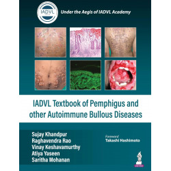 IADVL Textbook of Pemphigus and other Autoimmune Bullous Diseases book by Sujay Khandpur, Raghavendra Rao