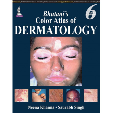 Bhutani’s Color Atlas of Dermatology book by Khanna Neena