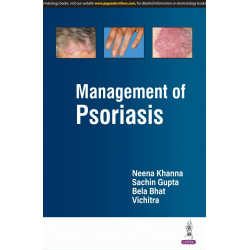 MANAGEMENT OF PSORIASIS book by Neena Khanna, Sachin Gupta