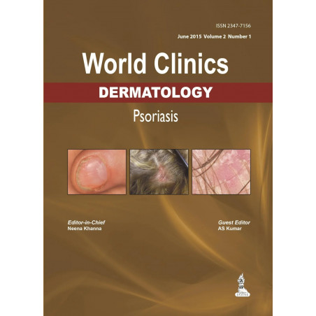 WORLD CLINICS DERMATOLOGY PSORIASIS JUNE 2015, VOL.2, NO.1: Volume 2, Number 1 book by Neena Khanna, A. S. Kumar