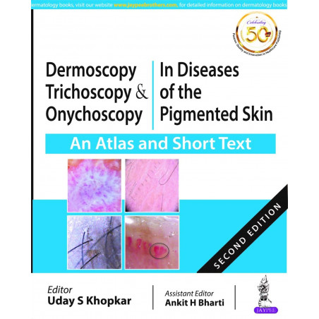 Dermoscopy, Trichoscopy & Onychoscopy in Diseases of the Pigmented Skin: An Atlas and Short Text book by Uday S Khopkar