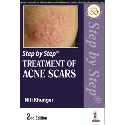 STEP BY STEP TREATMENT OF ACNE SCARS book by M.D. Khunger, Niti