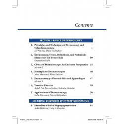 Dermoscopy, Trichoscopy & Onychoscopy in Diseases of the Pigmented Skin: An Atlas and Short Text book by Uday S Khopkar - Additi