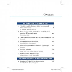 Dermoscopy, Trichoscopy & Onychoscopy in Diseases of the Pigmented Skin: An Atlas and Short Text book by Uday S Khopkar - Additi