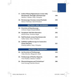 Dermoscopy, Trichoscopy & Onychoscopy in Diseases of the Pigmented Skin: An Atlas and Short Text book by Uday S Khopkar - Additi