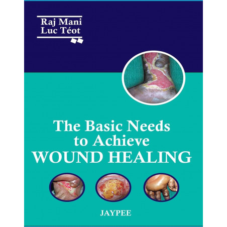 THE BASIC NEEDS TO ACHIEVE WOUND HEALING book by Raj Mani