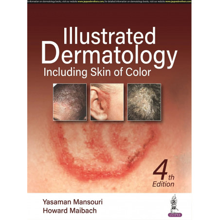 ILLUSTRATED DERMATOLOGY INCLUDING SKIN OF COLOR book by Yasaman Mansouri