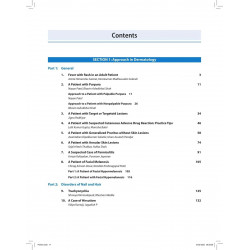 APPROACH AND OBSERVATION IN CLINICAL DERMATOLOGY book by Jigna Padhiyar - Additional Image 5