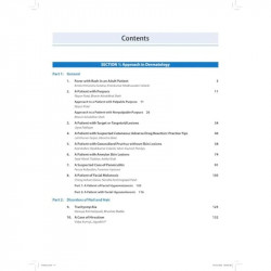 APPROACH AND OBSERVATION IN CLINICAL DERMATOLOGY book by Jigna Padhiyar - Additional Image 6