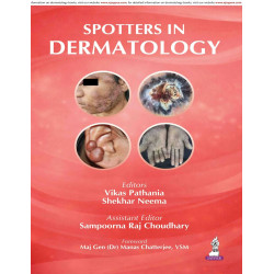 Spotters in Dermatology: Focused Handbook for MD/DNB Residents and Examiners | High-Yield Viva Guide with 39 Spotters, Diffe…