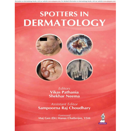 Spotters in Dermatology: Focused Handbook for MD/DNB Residents and Examiners | High-Yield Viva Guide with 39 Spotters, Diffe…