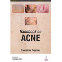 HANDBOOK ON ACNE book by Swetalina Pradhan, Rashid Shahid