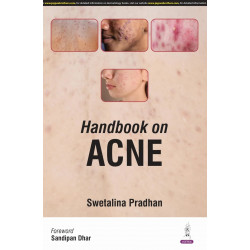 HANDBOOK ON ACNE book by Swetalina Pradhan, Rashid Shahid