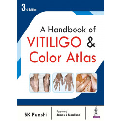 A Handbook of Vitiligo & Color Atlas book by SK Punshi