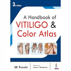 A Handbook of Vitiligo & Color Atlas book by SK Punshi - Back Cover