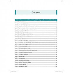 DYP Dermatopathology Handbook: Punch to Proof for Dermatology Postgraduates and Dermatologists | 51 Case-based Clinicopathol… -