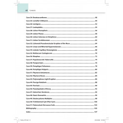 DYP Dermatopathology Handbook: Punch to Proof for Dermatology Postgraduates and Dermatologists | 51 Case-based Clinicopathol… -