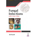 FUNGAL INFECTIONS WITH COLOR ALTAS book by SK Punshi