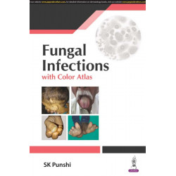 FUNGAL INFECTIONS WITH COLOR ALTAS book by SK Punshi