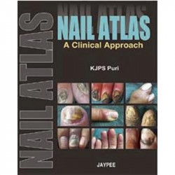 NAIL ATLAS A CLINICAL APPROACH book