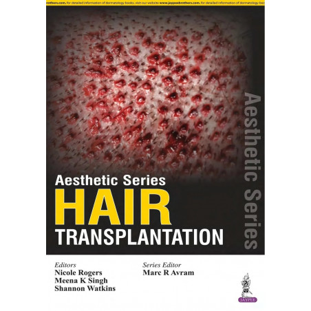 AESTHETIC SERIES:HAIR TRANSPLANTATION book by Rogers Nicole